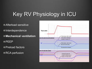 What Is Rv Preload ICN Victoria: Burrell on