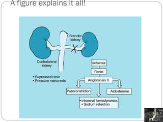 A figure explains it all! 