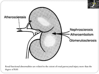 Renal functional abnormalities are related to the extent of renal parencymal injury more than the degree of RAS 
