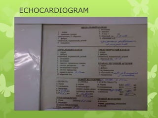 ECHOCARDIOGRAM
 