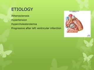 ETIOLOGY
Atherosclerosis
Hypertension
Hypercholesterolemia
Progressive after left ventricular infarction
 