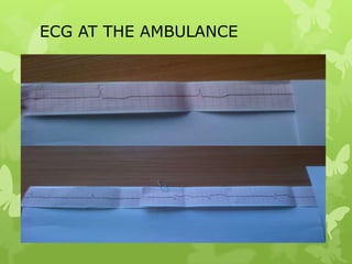 ECG AT THE AMBULANCE
 