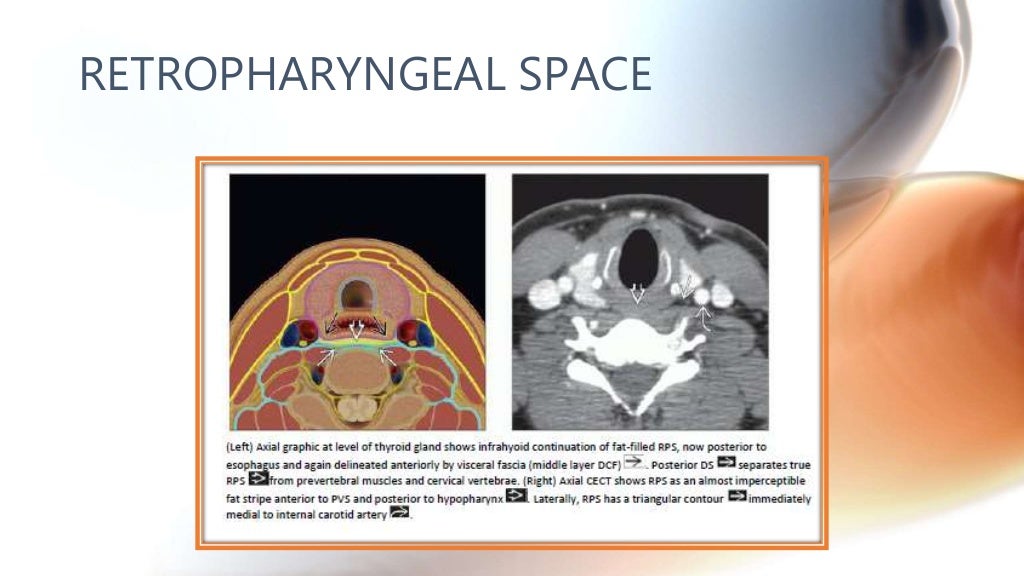 CT anatomy of Neck Spaces RV