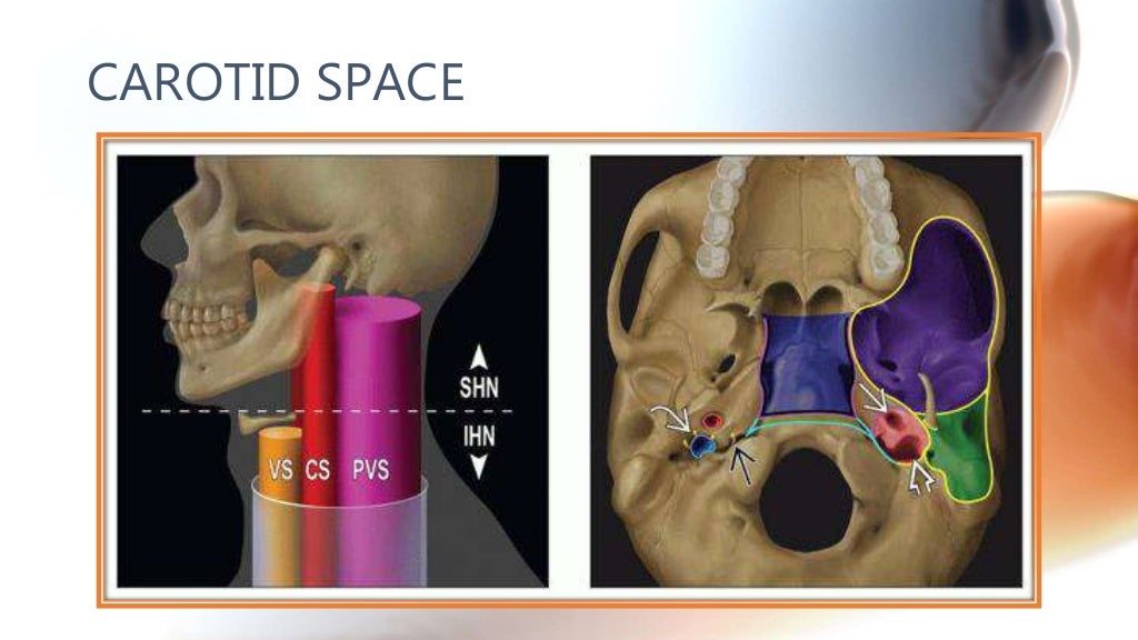 CT anatomy of Neck Spaces RV