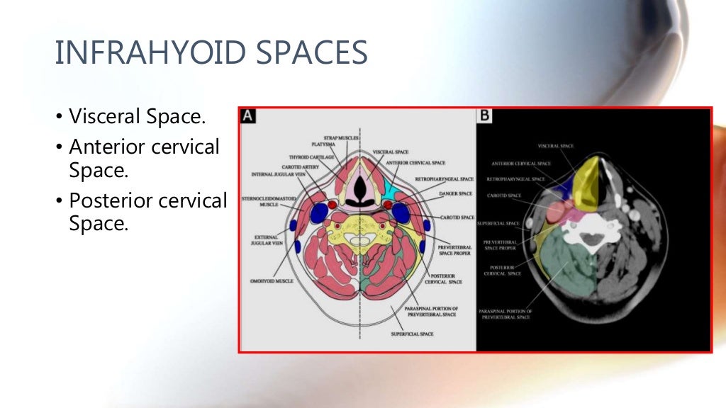 CT anatomy of Neck Spaces RV