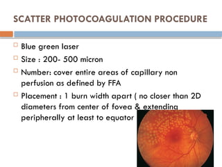 SCATTER PHOTOCOAGULATION PROCEDURE
 Blue green laser
 Size : 200- 500 micron
 Number: cover entire areas of capillary non
perfusion as defined by FFA
 Placement : 1 burn width apart ( no closer than 2D
diameters from center of fovea & extending
peripherally at least to equator
 