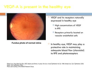 VEGF-A is present in the healthy eye
 VEGF and its receptors naturally
expressed in healthy eye
 High concentrations of VEGF
in RPE
 Receptors primarily located on
vascular endothelial cells
 In healthy eye, VEGF may play a
protective role in maintaining
adequate blood flow (choroidal)
to RPE and photoreceptors
Witmer et al, Prog Retin Eye Res, 2003; Adamis and Shima, In press; Kim et al, Invest Ophthalmol Vis Sci, 1999; Ambati et al, Surv Ophthalmol, 2003;
Zarbin, Arch Ophthalmol, 2004.
Photo used courtesy of the AREDS Research Group.
Fundus photo of normal retina
 