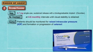 0.7 mg single-use, sustained release with a biodegradeable implant (Ozurdex)
at 4-6 monthly intervals until visual stability is obtained
Patients should be monitored for raised intraocular pressure
(IOP) and formation or progression of cataract
 
