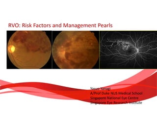 RVO: Risk Factors and Management Pearls
Yasuo Yanagi
A/Prof Duke NUS Medical School
Singapore National Eye Centre
Singapore Eye Research Institute
 