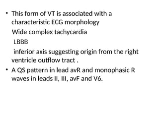 • This form of VT is associated with a
characteristic ECG morphology
Wide complex tachycardia
LBBB
inferior axis suggesting origin from the right
ventricle outflow tract .
• A QS pattern in lead avR and monophasic R
waves in leads II, III, avF and V6.
 