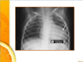 Radiology Spotters for undergraduates | PPTX