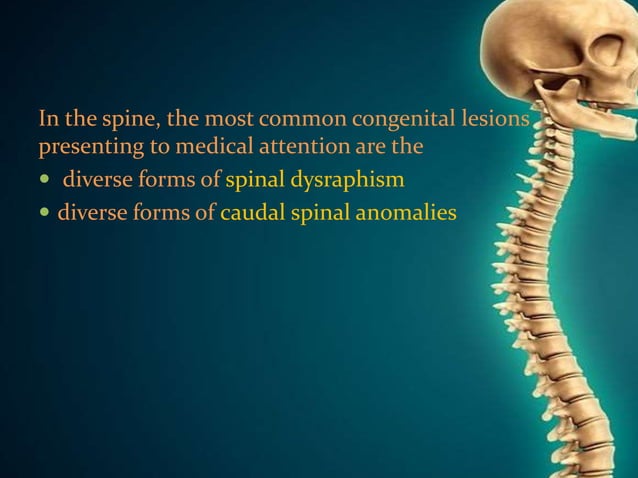 Congenital Anomalies Of Spine And Spinal Cord PPTX Brain And congenital-anomalies-of-spine-and-spinal-cord-pptx-brain-and