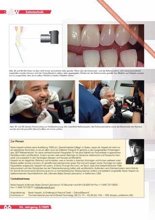 Zahntechnik




 Abb. 85 und 86 Die Natur ist aber nicht immer symmetrisch oder gerade. Wenn also die Farbmuster- und die Referenzzähne nicht achsensymmetrisch
 angehalten werden können, wird der Farbschlüssel im selben, aber gespiegelten Winkel wie der Referenzzahn gestellt. Das Blitzlicht und Objektiv werden
 nun so ausgerichtet, dass sie im selben Winkel zu beiden Objekten stehen




 Abb. 87 und 88 Ideales Fotoshooting zur Farbbestimmung: Der natürliche Referenzzahn, die Farbmusterzähne sowie die Brennweite der Kamera
 wurden korrekt gewählt. Hierauf sollten wir immer achten




  Zur Person

  Naoki Hayashi schloss seine Ausbildung 1993 am „Dental Institute College“ in Osake/Japan ab. Hayashi ist nicht nur
  ein talentierter Keramiker, er ist vor allem auch ein brillanter Fotograf. Er gehörte zu den ausgewählten Preisträgern
  des „QDT Meisterstücks“ für seine zahntechnischen Fotografien. Er hat eine Vielzahl von Fachartikeln in japanischen
  Dentaljournalen veröffentlicht. Zudem wurden viele seiner Beiträge ins Deutsche, Italienische und Russische über-
  setzt und zusätzlich in den Vereinigten Staaten und Kanada veröffentlicht.
  Hayashi ist ein begehrter Referent und Kursleiter, was er bereits in diversen Vorträgen und Kursen weltweit unter
  Beweis stellen konnte und kann. Er genießt international einen guten Ruf und wird wegen seiner Vorträge von vielen
  Kapazitäten aufgesucht. Hayashi hat zudem „A Diary Through the Lens“, ein Buch, dass eine Vielzahl klinischer Fälle
  dokumentiert und den Zahnärzten bei der Patientenberatung helfen soll, veröffentlicht. Außerdem wird Zahntechnikern darin Schritt
  für Schritt die keramische Schichtung bis hin zu hochästhetischen Restaurationen erklärt und bebildert vorgestellt. Naoki Hayashi ist
  stellvertretender Geschäftsführer des „Ultimate Styles Dental Laboratory“ in Kalifornien/USA.

  Kontaktadresse

  Naoki Hayashi •Ultimate Styles Dental Laboratory • 12 Mauchly • Unit M • CA-92618 • Fon +1 946 727-0822
  Fax +1 949 727-0577 • info@ultimate-dl.com

  Originalbeitrag:    Naoki Hayashi „A Challenge to Natural Teeth – Colors&Beyond”
  Erschienen in:      The International Journal of Dental Technology, 36 (1): 15 – 43,36 (2): 149 – 168, Ishiyaku, publishers, INC.




66          03. Jahrgang 3/2009
 
