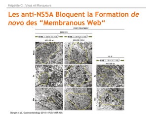 Les anti-NS5A Bloquent la Formation de
novo des “Membranous Web“
Berger et al., Gastroenterology 2014;147(5):1094-105.
Hép...