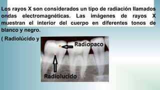 Rx | PPTX