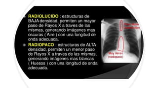 Rx | PPTX