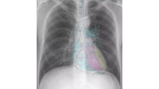 Comprehensive Guide to Chest Radiography and Imaging Basics | PPTX