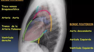 Comprehensive Guide to Chest Radiography and Imaging Basics | PPTX