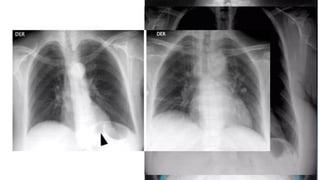 Comprehensive Guide to Chest Radiography and Imaging Basics | PPTX