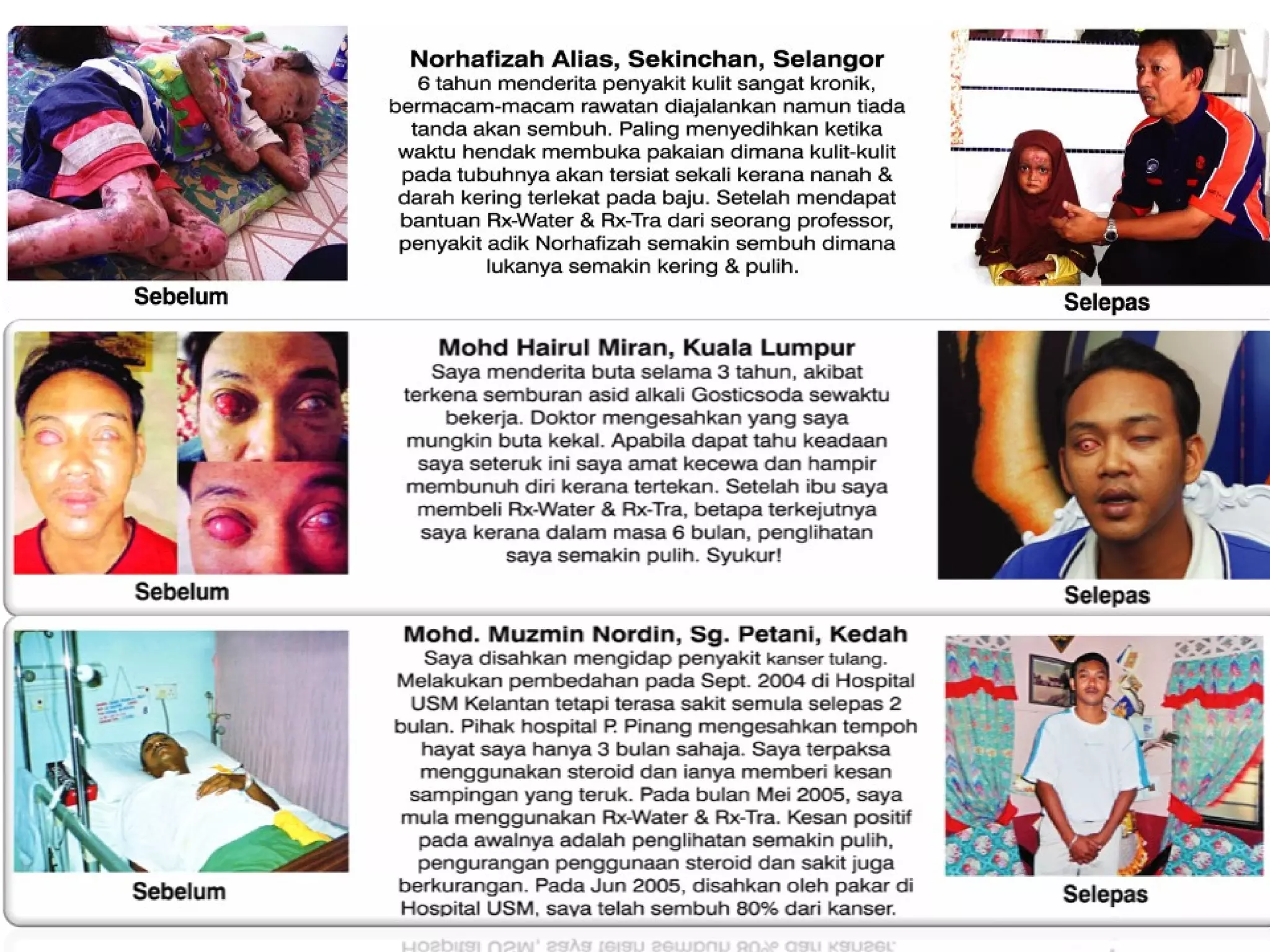 Testimonies from RX-WATER Therapy 