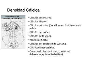 Densidad Cálcica
• Cálculos Vesiculares.
• Cálculos biliares.
• Cálculos urinarios (Coraliformes, Caliciales, de la
pelvis)
• Cálculos del uréter.
• Cálculos de la vejiga.
• Vejiga calcificada.
• Cálculos del conducto de Wirsung.
• Calcificación prostática.
• Otras: vesículas seminales, conductos
deferentes, quistes (hidatídico)

 
