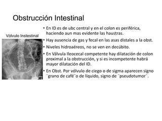 Obstrucción Intestinal
• En ID es de ubc central y en el colon es periférica,
haciendo aun mas evidente las haustras.
Vólvulo Instestinal
• Hay ausencia de gas y fecal en las asas distales a la obst.
• Niveles hidroaéreos, no se ven en decúbito.
• En Válvula Ileocecal competente hay dilatación de colon
proximal a la obstrucción, y si es incompetente habrá
mayor dilatación del ID.
• En Obst. Por vólvulo de ciego o de sigma aparecen signo
¨grano de café¨o de líquido, signo de ¨pseudotumor¨.

 