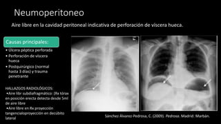 Rx Abdomen pptx