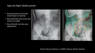 rx abdomen.pptx