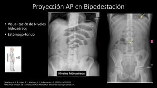 rx abdomen.pptx