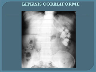 Rx abdomen wisha | PPT