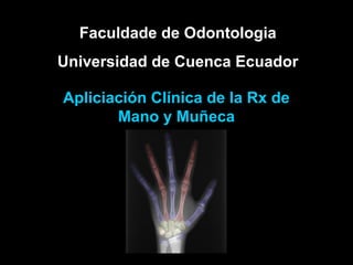 Faculdade de Odontologia
Universidad de Cuenca Ecuador
Apliciación Clínica de la Rx de
Mano y Muñeca
 