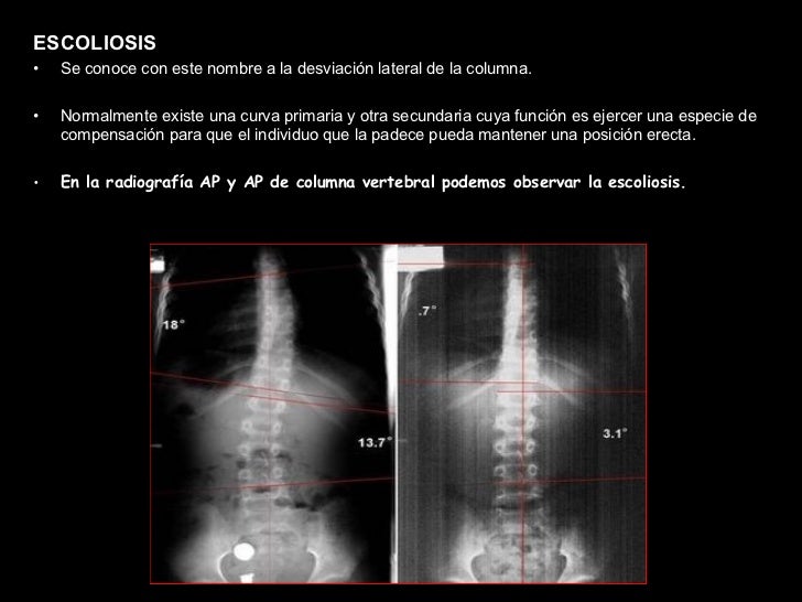 Las clínicas por el tratamiento de las hernias de la columna vertebral sin operación