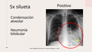 Abc Radiografía Radiografías cervical, tórax, abdomen y pelvis | PPTX