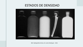 Abc Radiografía Radiografías cervical, tórax, abdomen y pelvis | PPTX