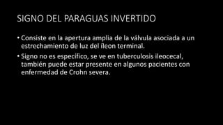 SIGNO DEL PARAGUAS INVERTIDO
• Consiste en la apertura amplia de la válvula asociada a un
estrechamiento de luz del íleon terminal.
• Signo no es específico, se ve en tuberculosis ileocecal,
también puede estar presente en algunos pacientes con
enfermedad de Crohn severa.
 