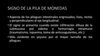 SIGNO DE LA PILA DE MONEDAS
• Aspecto de los pliegues intestinales engrosados, lisos, rectos
y perpendiculares al eje longitudinal.
• El signo se presenta cuando existe infiltración difusa de la
submucosa por edema o hemorragia intramural
(traumatismo, isquemia, toma de anticoagulantes, etc.)
• Más evidente en yeyuno por el mayor tamaño de los
pliegues
 