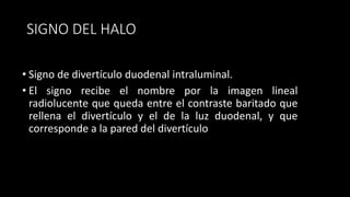 SIGNO DEL HALO
• Signo de divertículo duodenal intraluminal.
• El signo recibe el nombre por la imagen lineal
radiolucente que queda entre el contraste baritado que
rellena el divertículo y el de la luz duodenal, y que
corresponde a la pared del divertículo
 