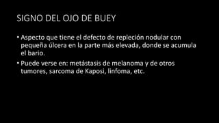 SIGNO DEL OJO DE BUEY
• Aspecto que tiene el defecto de repleción nodular con
pequeña úlcera en la parte más elevada, donde se acumula
el bario.
• Puede verse en: metástasis de melanoma y de otros
tumores, sarcoma de Kaposi, linfoma, etc.
 