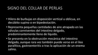 SIGNO DEL COLLAR DE PERLAS
• Hilera de burbujas en disposición vertical u oblicua, en
decúbito supino o en bipedestación.
• Representa pequeñas cantidades de aire atrapado en las
válvulas conniventes del intestino delgado,
predominantemente lleno de líquido.
• Se presenta en la obstrucción mecánica del intestino
delgado, aunque rara vez también puede verse en el íleo
paralítico, gastroenteritis o tras la aplicación de un enema
salino.
 