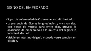 SIGNO DEL EMPEDRADO
• Signo de enfermedad de Crohn en el estudio baritado.
• La presencia de úlceras longitudinales y transversales,
con islotes de mucosa sana entre ellas, provoca la
apariencia de empedrado en la mucosa del segmento
intestinal afectado.
• Visible en intestino delgado y puede verse también en
el colon.
 