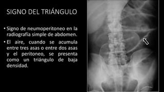 SIGNO DEL TRIÁNGULO
• Signo de neumoperitoneo en la
radiografía simple de abdomen.
• El aire, cuando se acumula
entre tres asas o entre dos asas
y el peritoneo, se presenta
como un triángulo de baja
densidad.
 