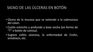 SIGNO DE LAS ÚLCERAS EN BOTÓN
• Úlcera de la mucosa que se extiende a la submucosa
del colon.
• Cuello estrecho y profundo y base ancha (en forma de
“T” o botón de camisa).
• Sugiere colitis ulcerosa, la enfermedad de Crohn,
amebiasis, etc.
 