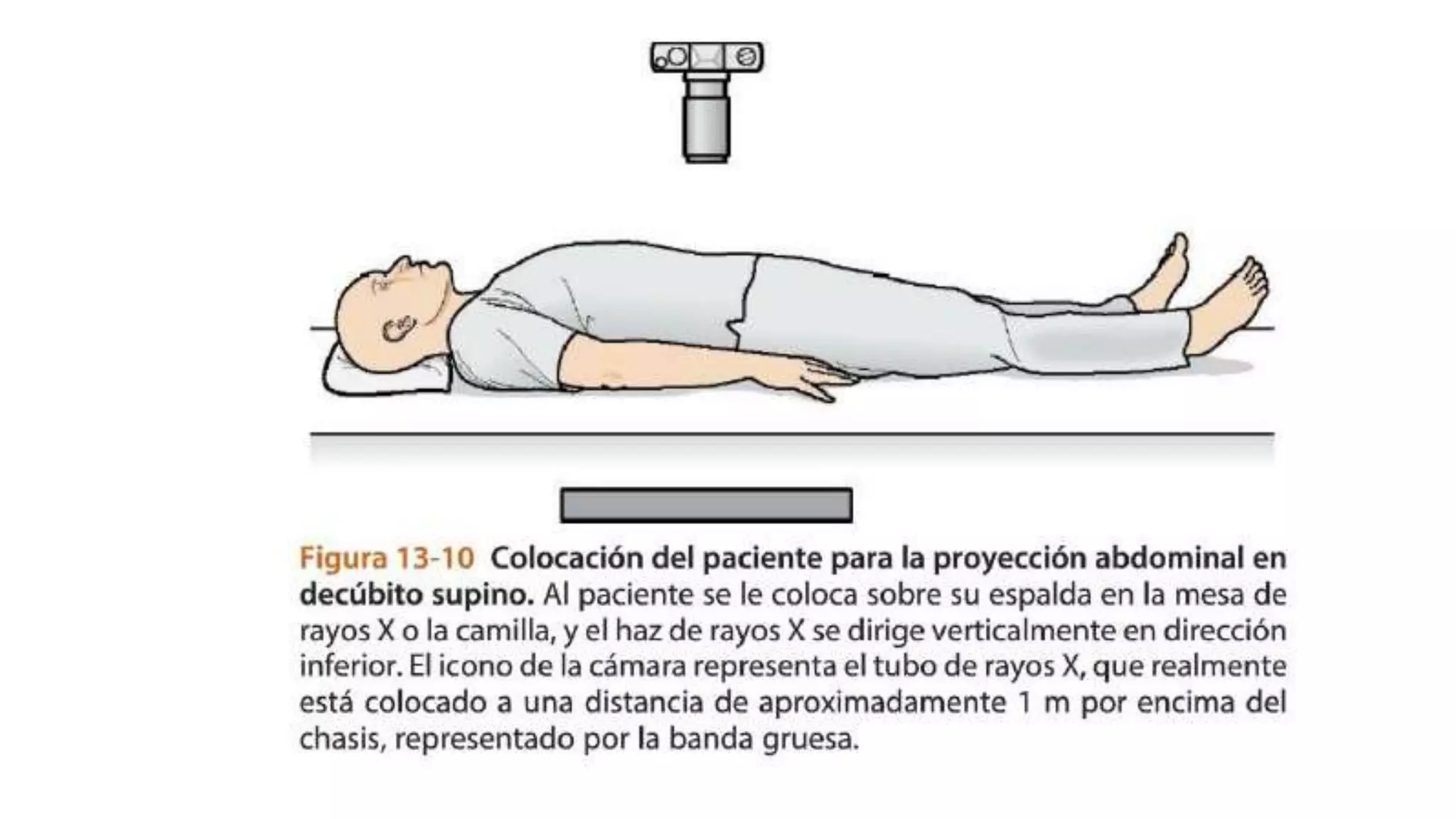 rx-de-abdomen-simple-en-dec-bito-bipedestaci-n-tangencial-patr-n