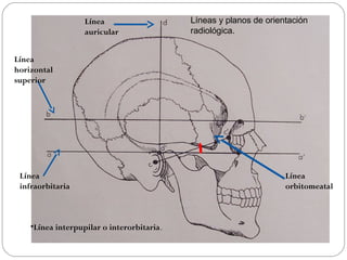 Rx de craneo | PPT