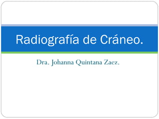 Dra. Johanna Quintana Zaez.
Radiografía de Cráneo.
 