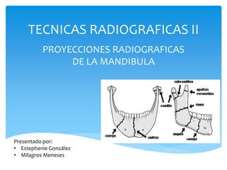 TECNICAS RADIOGRAFICAS II
PROYECCIONES RADIOGRAFICAS
DE LA MANDIBULA
Presentado por:
• Estephanie González
• Milagros Meneses
 