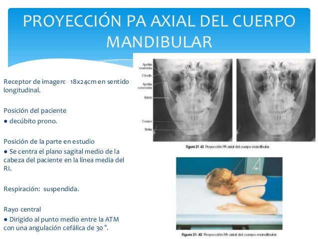 Minimoi Body Scanner 3D OCCASION