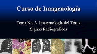 Curso de Imagenología 
Neumologia 
Pediatrica 
Andres 
Aguilar 
Tema No. 3 Imagenología del Tórax 
Signos Radiográficos 
 