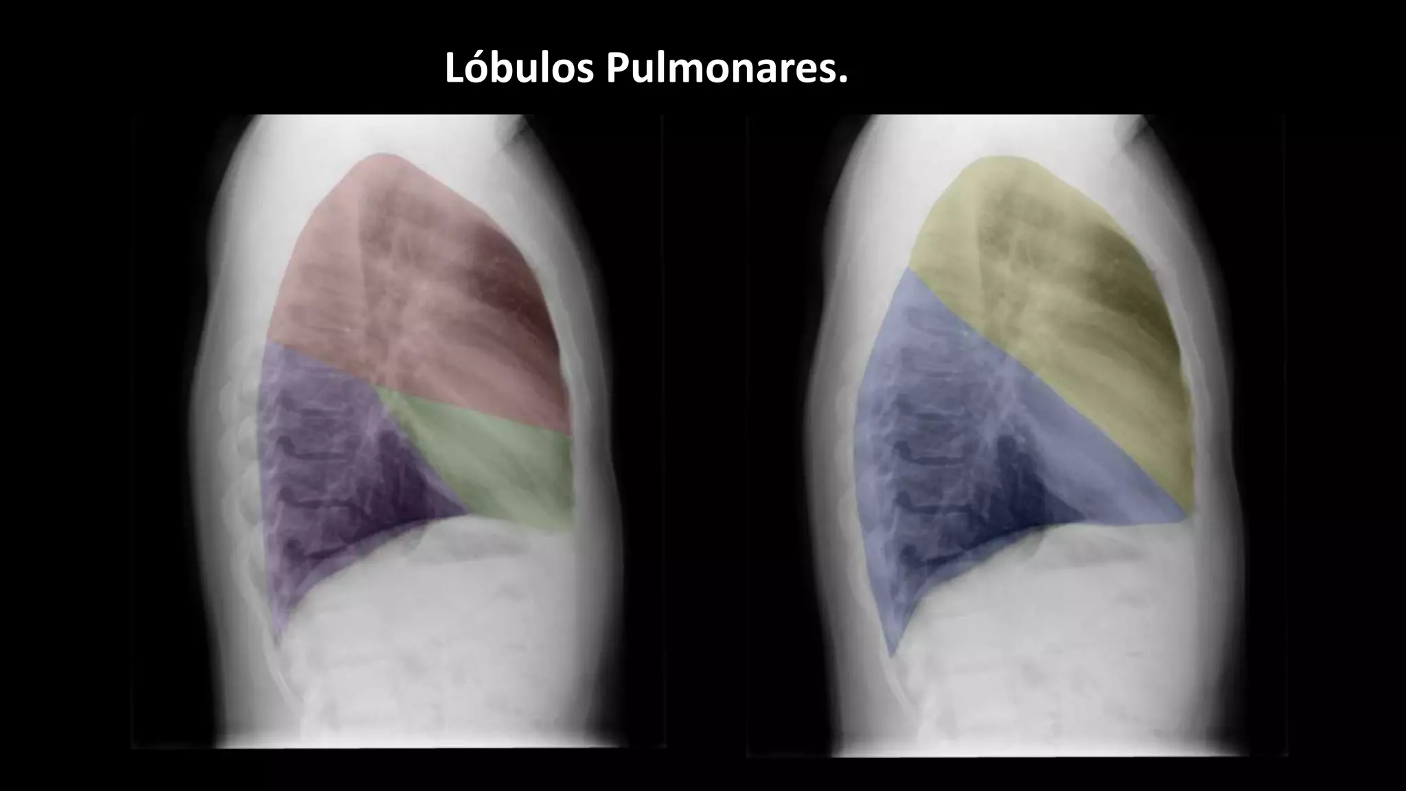 Torax Inestable Rx RX de torax.pptx | Lung and Respiratory Health | Diseases and Conditions