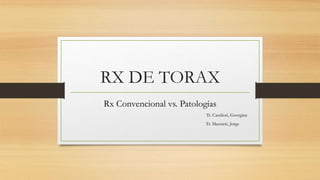 RX DE TORAX
Rx Convencional vs. Patologías
Tr. Candioti, Georgina
Tr. Mazzieri, Jorge
 